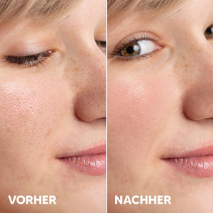 AHA Fruchtsäure Serum 3% Glykolsäure + 2% Milchsäure | Rossen Kosmetik