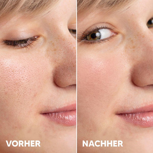 AHA Fruchtsäure Serum 3% Glykolsäure + 2% Milchsäure | Rossen Kosmetik