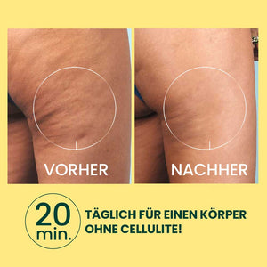 ANTI - CELLULITE MASSAGEGERÄT – MASSAGEROLLER GEGEN CELLULITE & FETTDEPOTS | Rossen Kosmetik