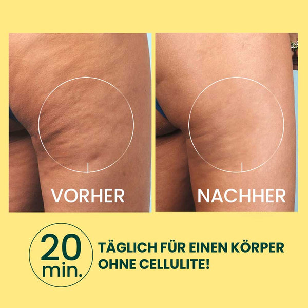 ANTI - CELLULITE MASSAGEGERÄT – MASSAGEROLLER GEGEN CELLULITE & FETTDEPOTS | Rossen Kosmetik