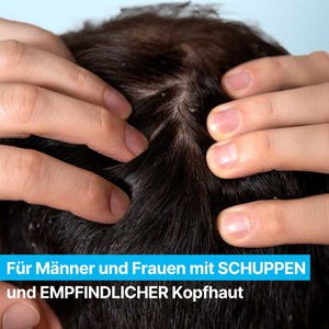 PFLEGE BEI JUCKENDER UND GEREIZTER KOPFHAUT | Rossen Kosmetik