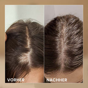 Bioelixier Haaröl mit Ingwer – Schnelleres Haarwachstum & starke Haarwurzeln | Rossen Kosmetik