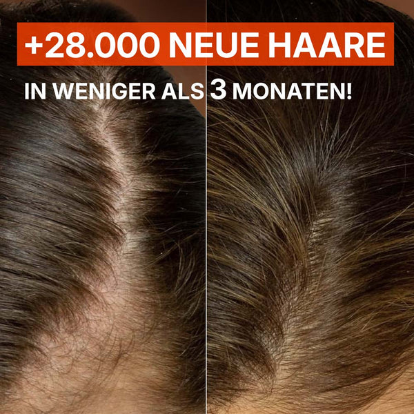 Duo - Pack Redensyl™ Ampullen für Haarwachstum – gegen Haarausfall & für dichtere Haare | Rossen Kosmetik