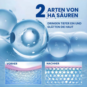 HA Filler Hyaluronsäure Gel – Intensiver Feuchtigkeitsbooster für pralle, glatte Haut | Rossen Kosmetik
