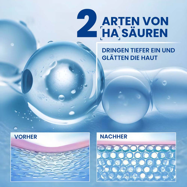 HA Filler Hyaluronsäure Gel – Intensiver Feuchtigkeitsbooster für pralle, glatte Haut | Rossen Kosmetik