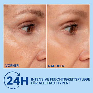 HA Filler Hyaluronsäure Gel – Intensiver Feuchtigkeitsbooster für pralle, glatte Haut | Rossen Kosmetik