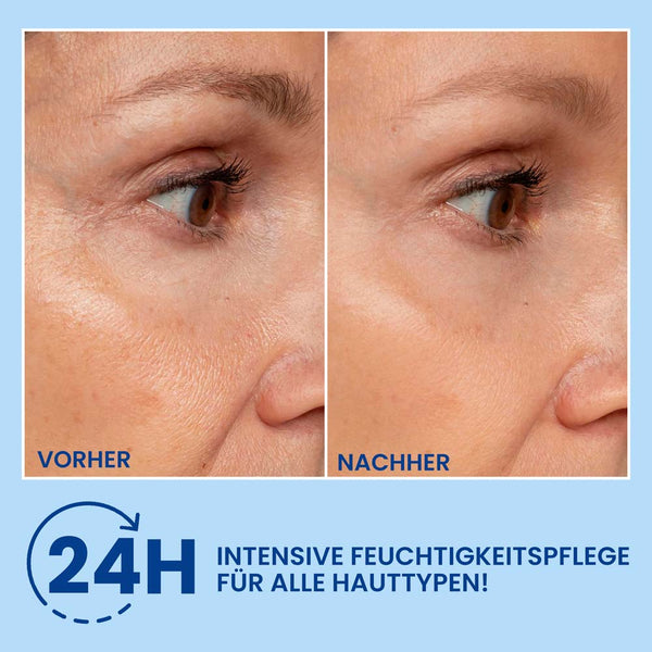 HA Filler Hyaluronsäure Gel – Intensiver Feuchtigkeitsbooster für pralle, glatte Haut | Rossen Kosmetik