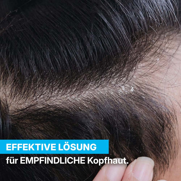 PFLEGE FÜR TROCKENE UND GEREIZTE KOPFHAUT | Rossen Kosmetik