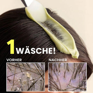 Scalp Detox Tonerde Kopfhaut Peeling gegen fettige Kopfhaut & Talgablagerungen | Rossen Kosmetik