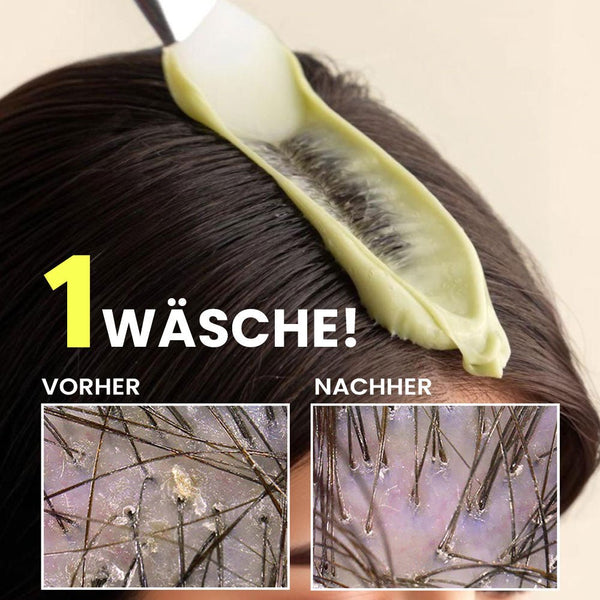 Scalp Detox Tonerde Kopfhaut Peeling gegen fettige Kopfhaut & Talgablagerungen | Rossen Kosmetik