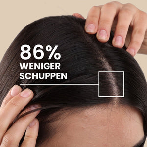 Scalp Rebalance Shampoo für fettige Kopfhaut | Rossen Kosmetik