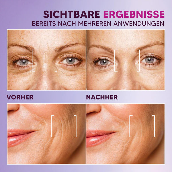 Serum mit Straffungseffekt – Hyaluron Lifting gegen Falten | Rossen Kosmetik