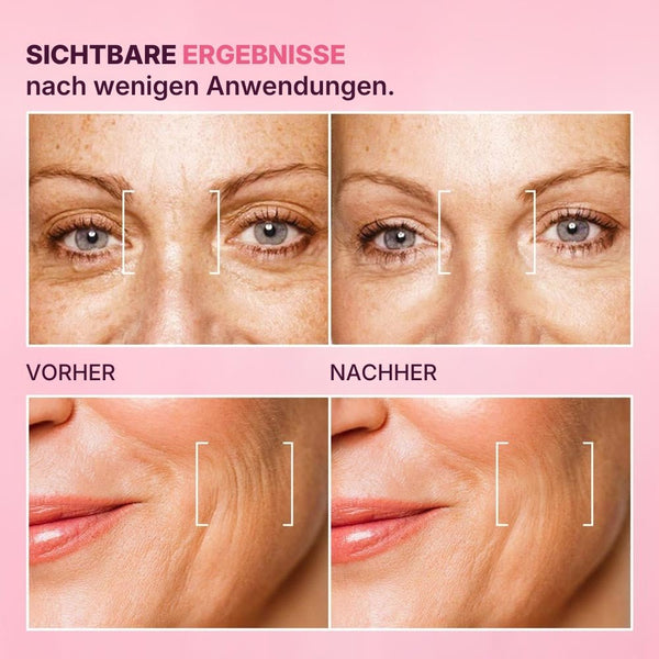 Serum mit Straffungseffekt – Hyaluronpflege gegen Falten | Rossen Kosmetik