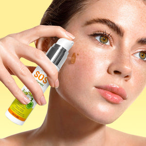 SOS Anti - Pickel Gel gegen Akne & Mitesser | Rossen Kosmetik