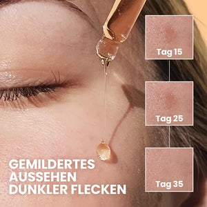 Vitamin C Serum – Hochdosiertes Gesichtsserum für strahlende, ebenmäßige Haut | Rossen Kosmetik