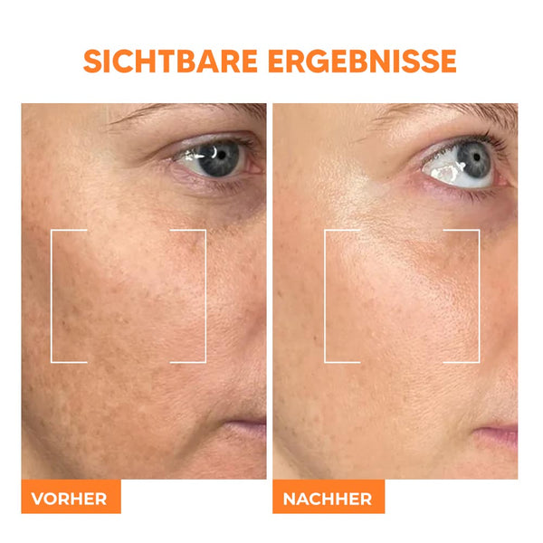 Vitamin C Serum – Hochdosiertes Gesichtsserum für strahlende, ebenmäßige Haut | Rossen Kosmetik